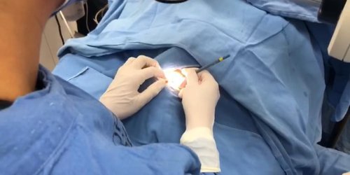 Este 27 de febrero: Digamos "Sí" a la vida y a la donación de órganos"