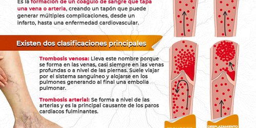 Servicios de Salud ha otorgado 27 atenciones por embolias y trombosis en el 2022