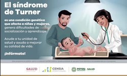 Síndrome de turner, enfermedad que afecta a mujeres