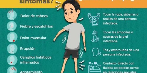 Detectan nuevo caso de viruela símica en SLP