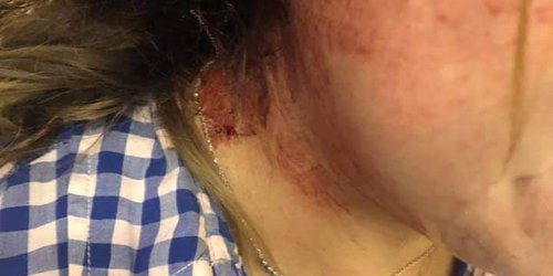 Buscan a potencial femenicida que atacó a su ex novia en Ciudad Valles