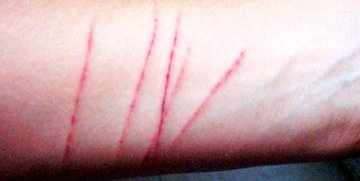 Aumenta cutting en niños de comunidades rurales