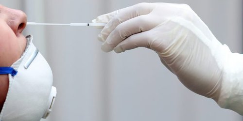 Registró el estado la demanda más alta de pruebas Covid-19