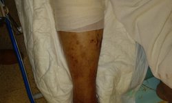 Policías de CdFdz hieren un balazo a vecino cuando "correteaban" a infractor que se les escapó
