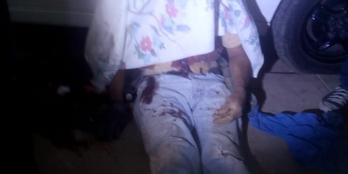 Custodio del penal de Río se dio un disparo en la mano