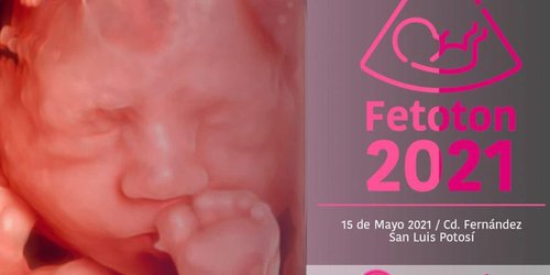 Jornada de consultas gratis de medicina fetal inicia este lunes en CdFdz