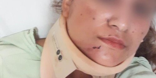 En convivio panista agreden a candidata a regidora en Tamasopo