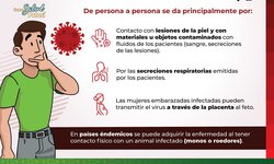 Es negativo, caso pendiente sospechoso de viruela símica: Salud