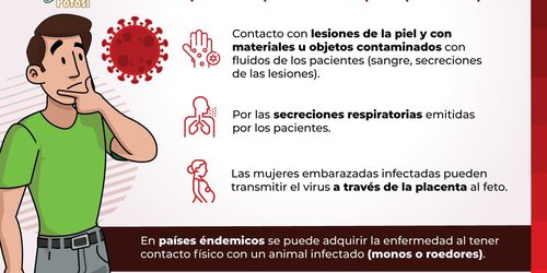 Es negativo, caso pendiente sospechoso de viruela símica: Salud