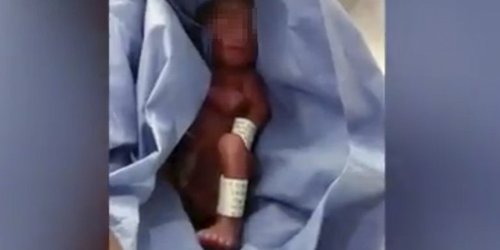 ″¡Está llorando, sigue vivo!”: conmoción en Puebla por caso de bebé que declararon muerto por error y mandaron a la morgue