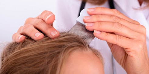 Niña muere por plaga de piojos tras vivir infestada por tres años