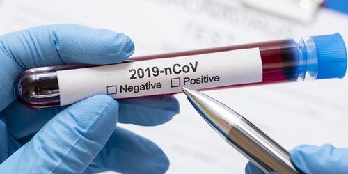 Otro caso de Covid entre personas que participaron en la gira de AMLO