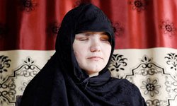 Khatera, mujer apuñalada en los ojos habla de la crueldad del Talibán en Afganistán