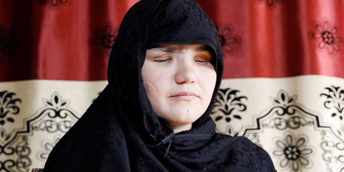 Khatera, mujer apuñalada en los ojos habla de la crueldad del Talibán en Afganistán