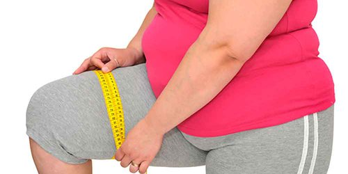 Cirugía bariátrica será una opción para tratar obesidad mórbida