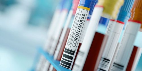 Coronavirus: la nueva prueba de anticuerpos que es "crucial" para hacer frente a pandemia del covid-19