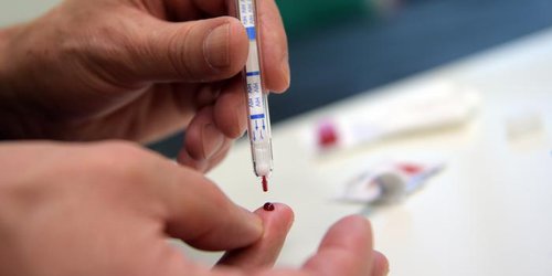 Detectan cuatro nuevos casos de SIDA en la región