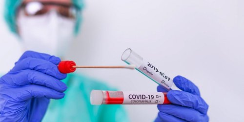 Coepris lleva aseguradas 2 mil pruebas rápidas de covid