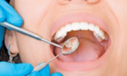 Más de 52 mil consultas dentales fueron otorgadas en 2020 por Servicios de Salud del Estado