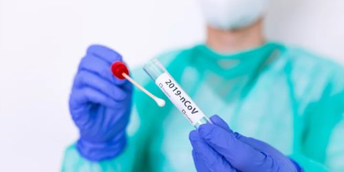 Pacientes con secuelas de Covid deben mantener vigilancia médica: Salud