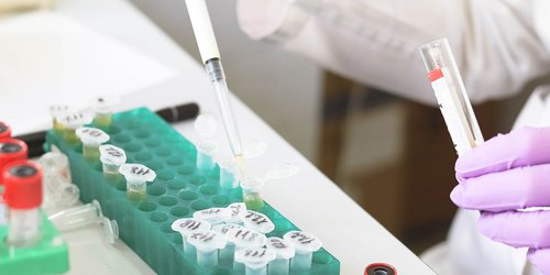 Más de ocho mil pruebas PCR para detectar Covid-19 se han aplicado en SLP