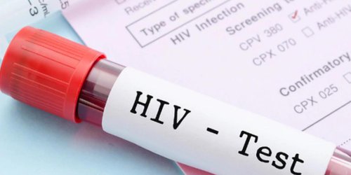 Llaman a potosinos a realizarse la prueba del VIH: Es gratuita, segura y confidencial.