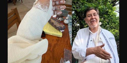 Fernández Noroña se fractura la muñeca tras sufrir una caída durante caminata en Tepoztlán.