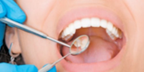 Más de 52 mil consultas dentales fueron otorgadas en 2020 por Servicios de Salud del Estado
